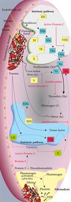 Investigation of the Molecular Mechanism of Coagulopathy in <mark class="highlighted">Severe and Critical</mark> Patients With COVID-19